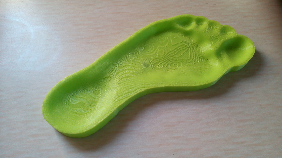 Form Fitting Insole